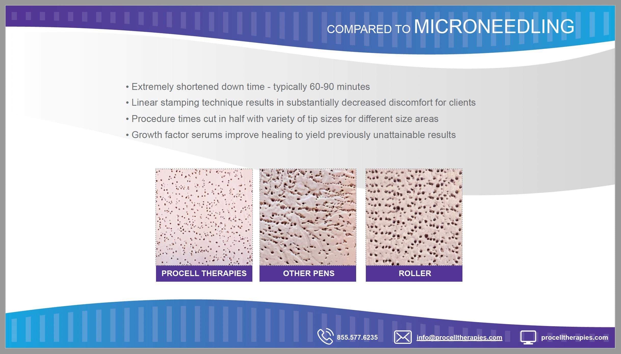 Procell Therapies Microchanneling Devices - For Professionals – Shop ...